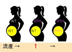 甲状腺ホルモン不応症(レフェトフ症候群)と妊娠 甲状腺ホルモン不応症(レフェトフ症候群)と妊娠