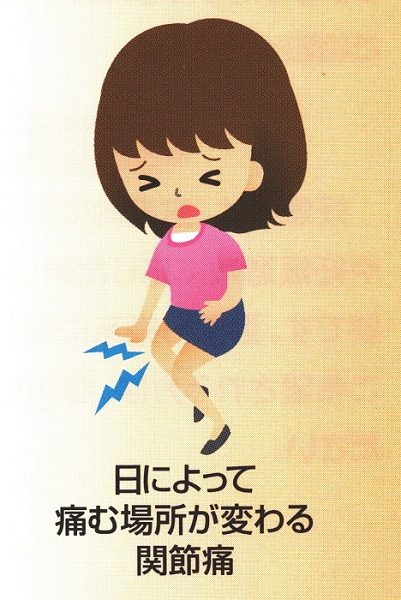 プロパジール関節痛 プロパジール関節痛