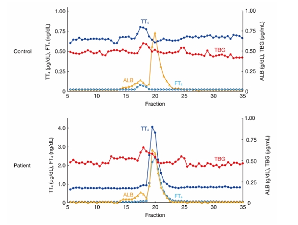 家族性異常アルブミン性高サイロキシン血症 ゲル濾過分析 家族性異常アルブミン性高サイロキシン血症 ゲル濾過分析