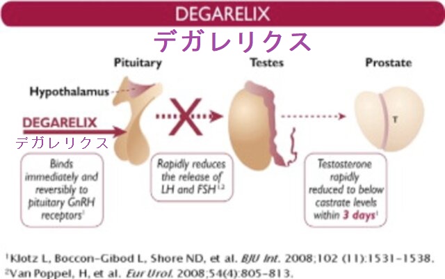 デガレリクス デガレリクス