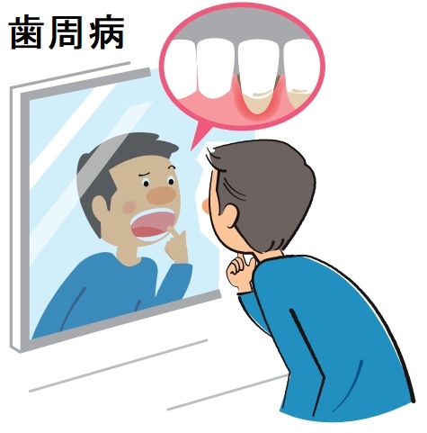 甲状腺と歯周病 甲状腺と歯周病