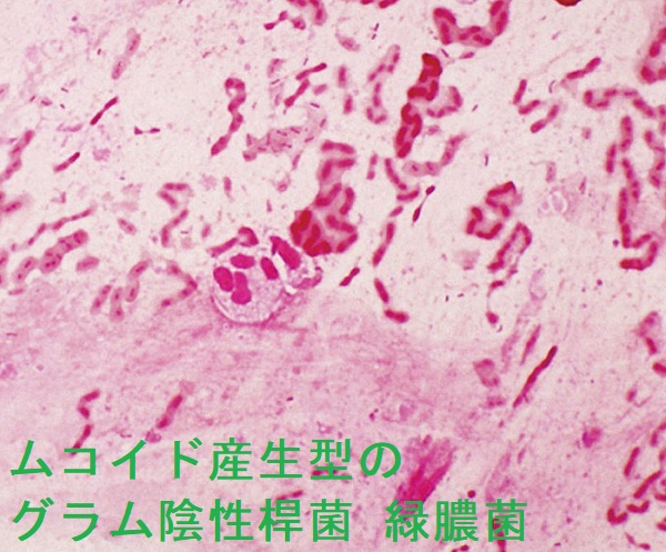 ムコイド産生型のグラム陰性桿菌 緑膿菌 ムコイド産生型のグラム陰性桿菌 緑膿菌