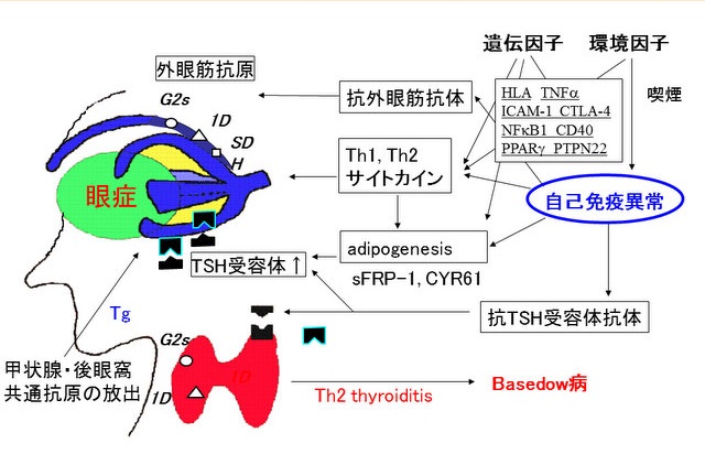 バセドウ病眼症(甲状腺眼症)の病因と病態 バセドウ病眼症(甲状腺眼症)の病因と病態