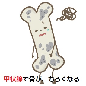 高齢者バセドウ病の大腿骨頚部骨折と大腿骨転子部骨折(脚の付け根の骨折) 高齢者バセドウ病の大腿骨頚部骨折と大腿骨転子部骨折(脚の付け根の骨折)