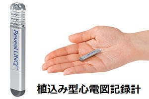 植込み型心電図記録計 植込み型心電図記録計