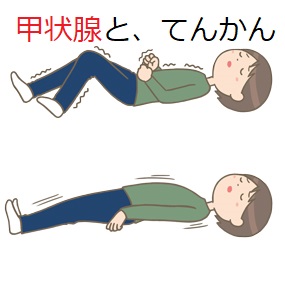 てんかんと甲状腺 てんかんと甲状腺
