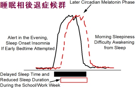 睡眠相後退症候群 睡眠相後退症候群
