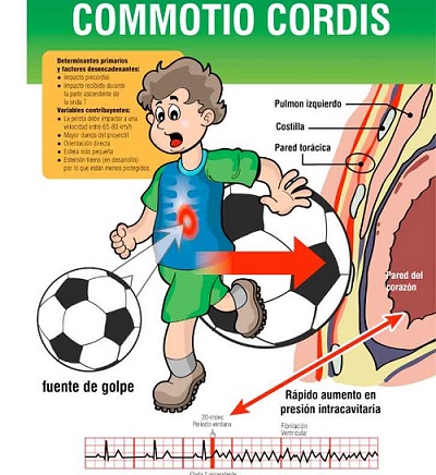 心臓震盪(しんぞうしんとう) 心臓震盪(しんぞうしんとう)