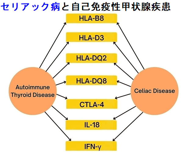 セリアック病と自己免疫性甲状腺疾患 セリアック病と自己免疫性甲状腺疾患