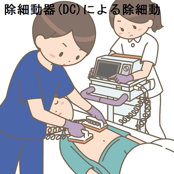 除細動 除細動