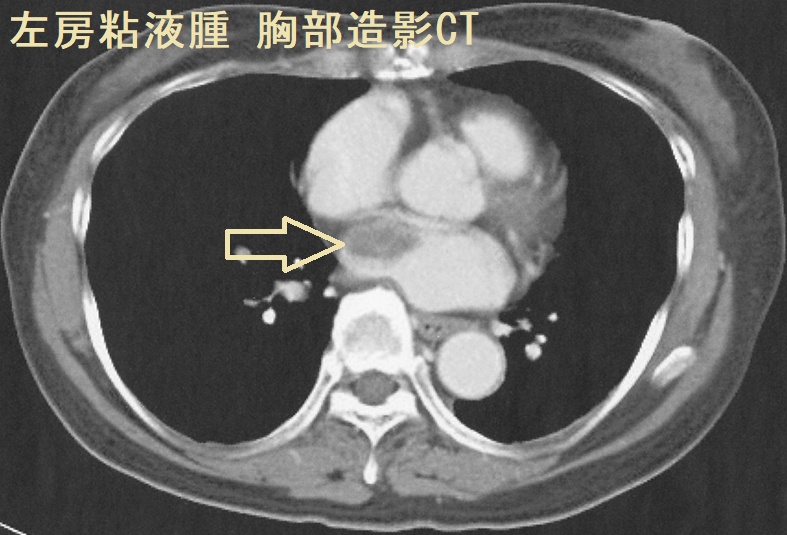 心臓腫瘍学 心臓腫瘍学 | 天野 純, 中山 淳, 池田 宇一 |本 | 通販 | Amazon