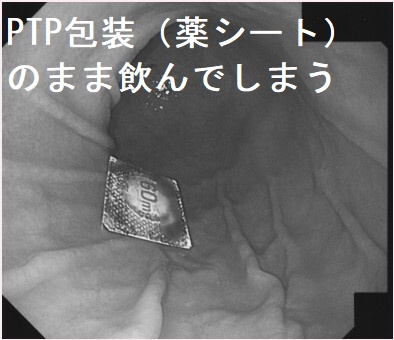PTP包装(薬シート)のまま飲んでしまう PTP包装(薬シート)のまま飲んでしまう