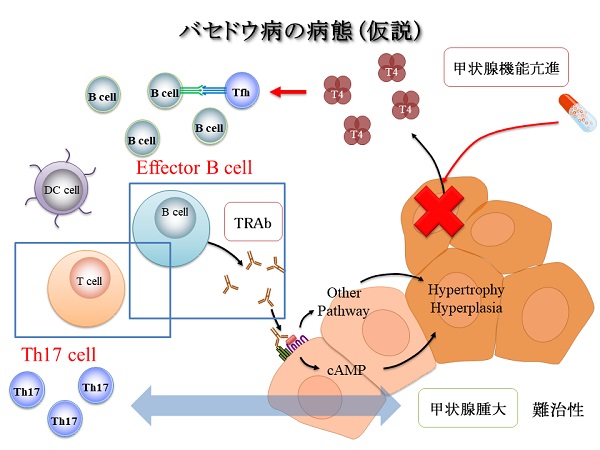 バセドウ病のリンパ球フェノタイプ バセドウ病のリンパ球フェノタイプ