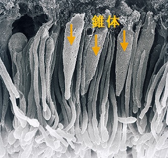 SITSH、難病甲状腺ホルモン不応症(レフェトフ症候群)[橋本病 SITSH、難病甲状腺ホルモン不応症(レフェトフ症候群)[橋本病