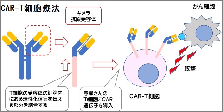 CAR-T細胞療法 CAR-T細胞療法