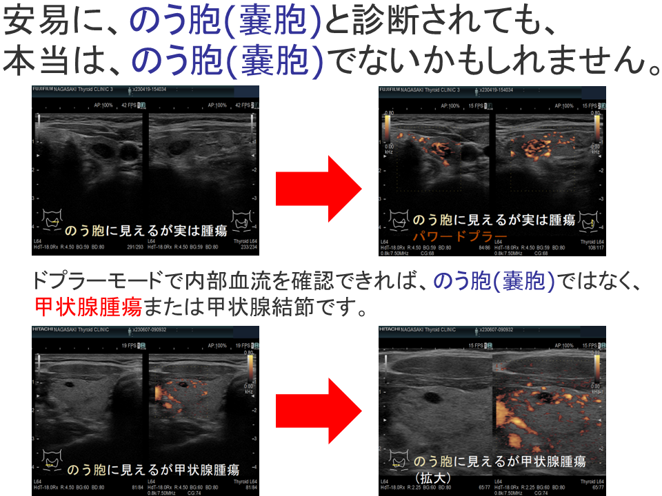 甲状腺・頸部の超音波診断 | 小西 淳二 |本 | 通販 | Amazon