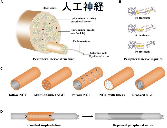 人工神経 人工神経