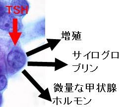 甲状腺分化癌細胞