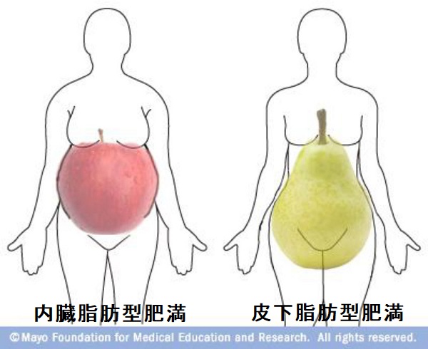 洋梨型体型 リンゴ型体型