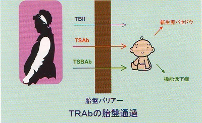 バセドウ病抗体(TR-Ab)胎盤通過