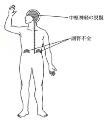 先天性副腎過形成、副腎白質ジストロフィー[日本甲状腺学会認定 甲状腺専門医橋本病 バセドウ病 甲状腺超音波(エコー)検査 長崎甲状腺クリニック(大阪)]
