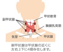 高カルシウム血症・低カルシウム血症は副甲状腺の病気