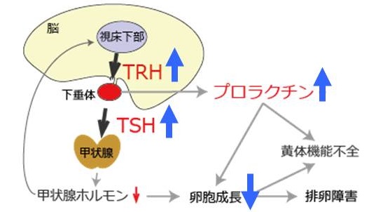 甲状腺と生理不順 月経前症候群 月経前緊張症 橋本病 バセドウ病 長崎甲状腺クリニック 大阪