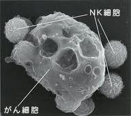 NK(ナチュラルキラー)細胞活性