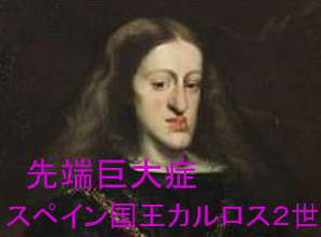 先端巨大症 先端巨大症