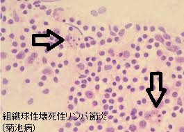 は 菊池 病 と 医療法人信岡会 菊池中央病院