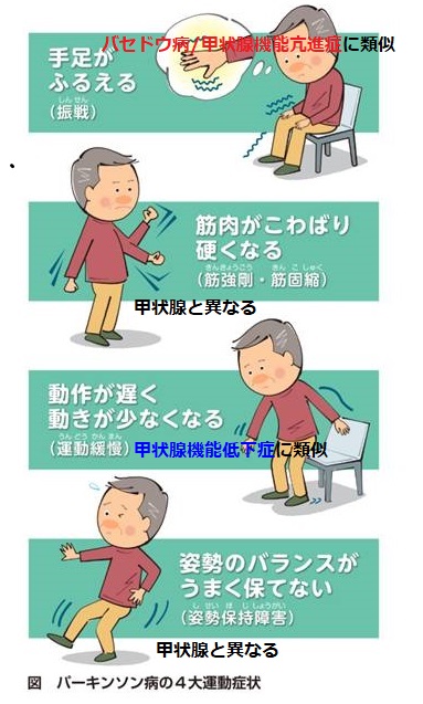 甲状腺と神経内科 パーキンソン病 多系統萎縮症 本態性振戦 アテトーゼ 長崎甲状腺クリニック大阪