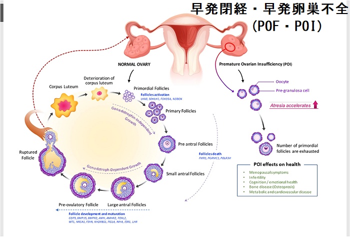 早発閉経・早発卵巣不全(POF・POI) 早発閉経・早発卵巣不全(POF・POI)