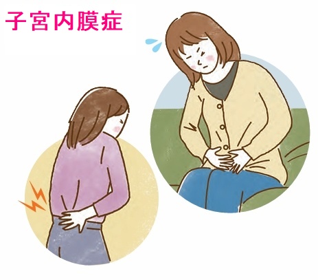 子宮内膜症と甲状腺 2 子宮内膜症と甲状腺 2