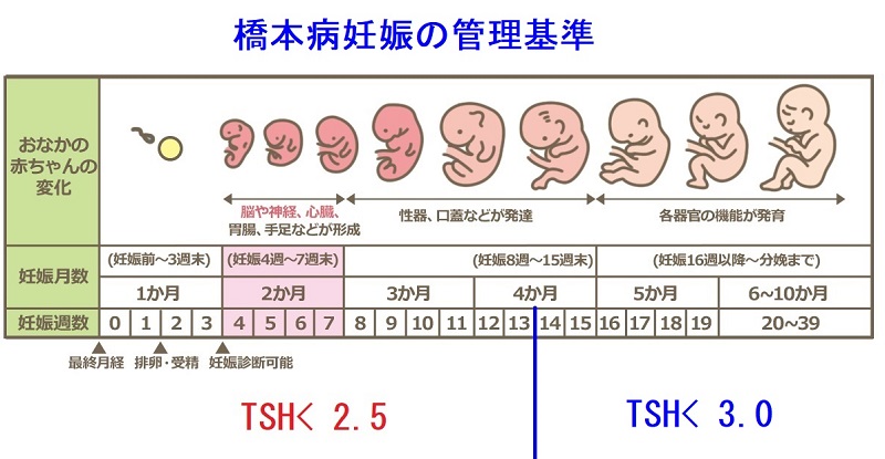 橋本病妊娠のい管理基準