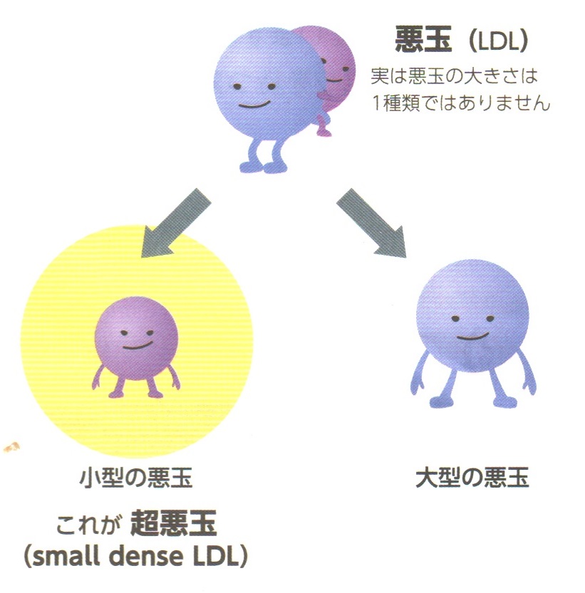 超悪玉コレステロール (small dense LDL-Cholesterol：sdLDL-C)