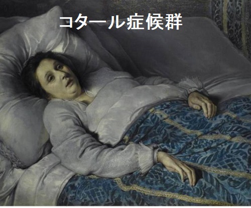 コタール症候群 コタール症候群