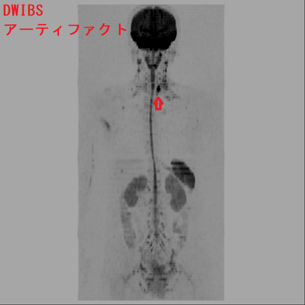 DWIBS(ドゥイブス) アーティファクト DWIBS(ドゥイブス) アーティファクト