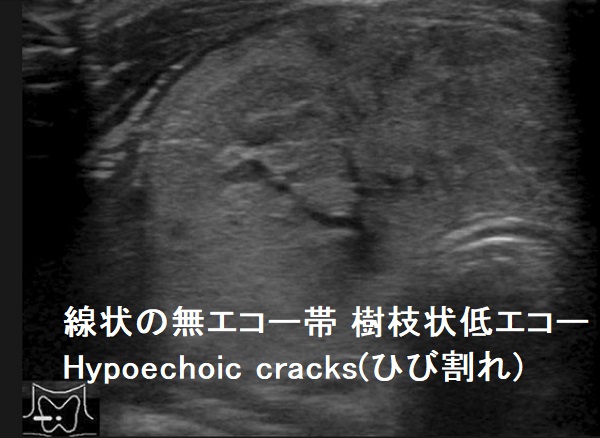 線状の無エコー帯 樹枝状低エコー Hypoechoic cracks(ひび割れ)3