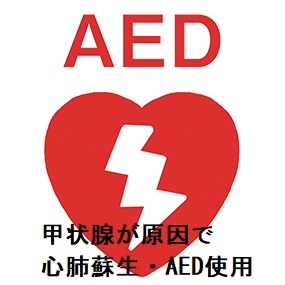 甲状腺が原因で心肺蘇生・AED使用 (電気ショック)