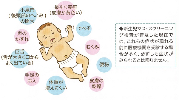 新生児マススクリーニングをすり抜けるクレチン症