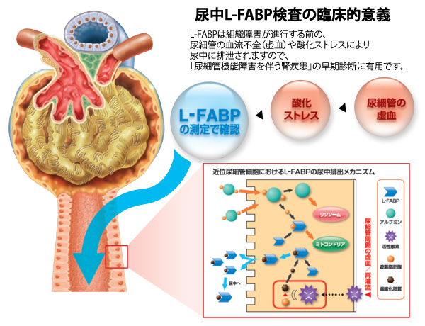 尿肝臓型脂肪酸結合蛋白（L-FABP）