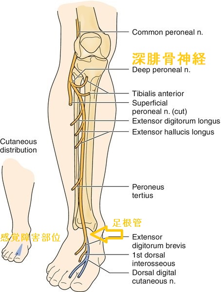 深腓骨神経